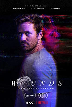 Wounds (2019) Dual Audio {Hin-Eng} 480p [200MB] | 720p [1GB] | 1080p [3GB] –